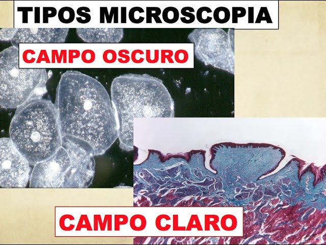 en que año se invento el microscopio de campo oscuro