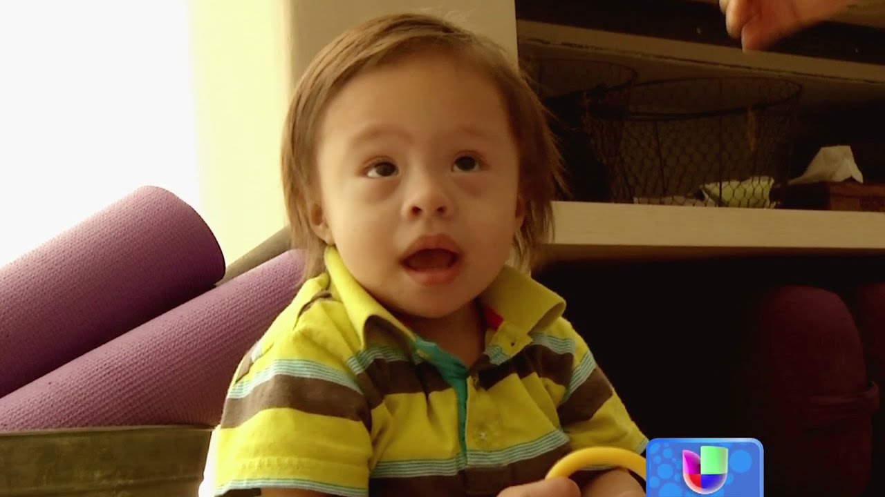 escuela para niños con sindrome de down en mexico