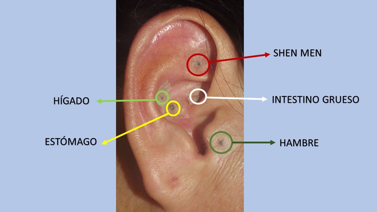 perforacion en la oreja para bajar de peso